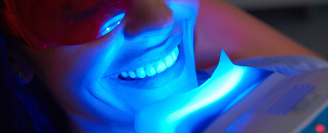 Teeth Whitening: Professional vs. At-Home Options