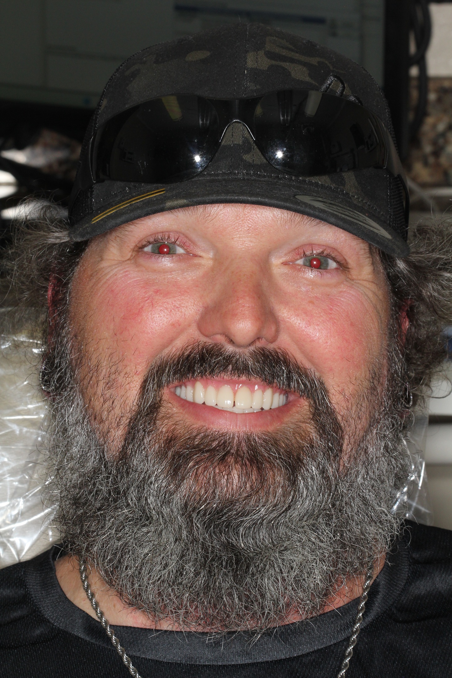 After Dental Implants at Aer Dental Studio Candler NC