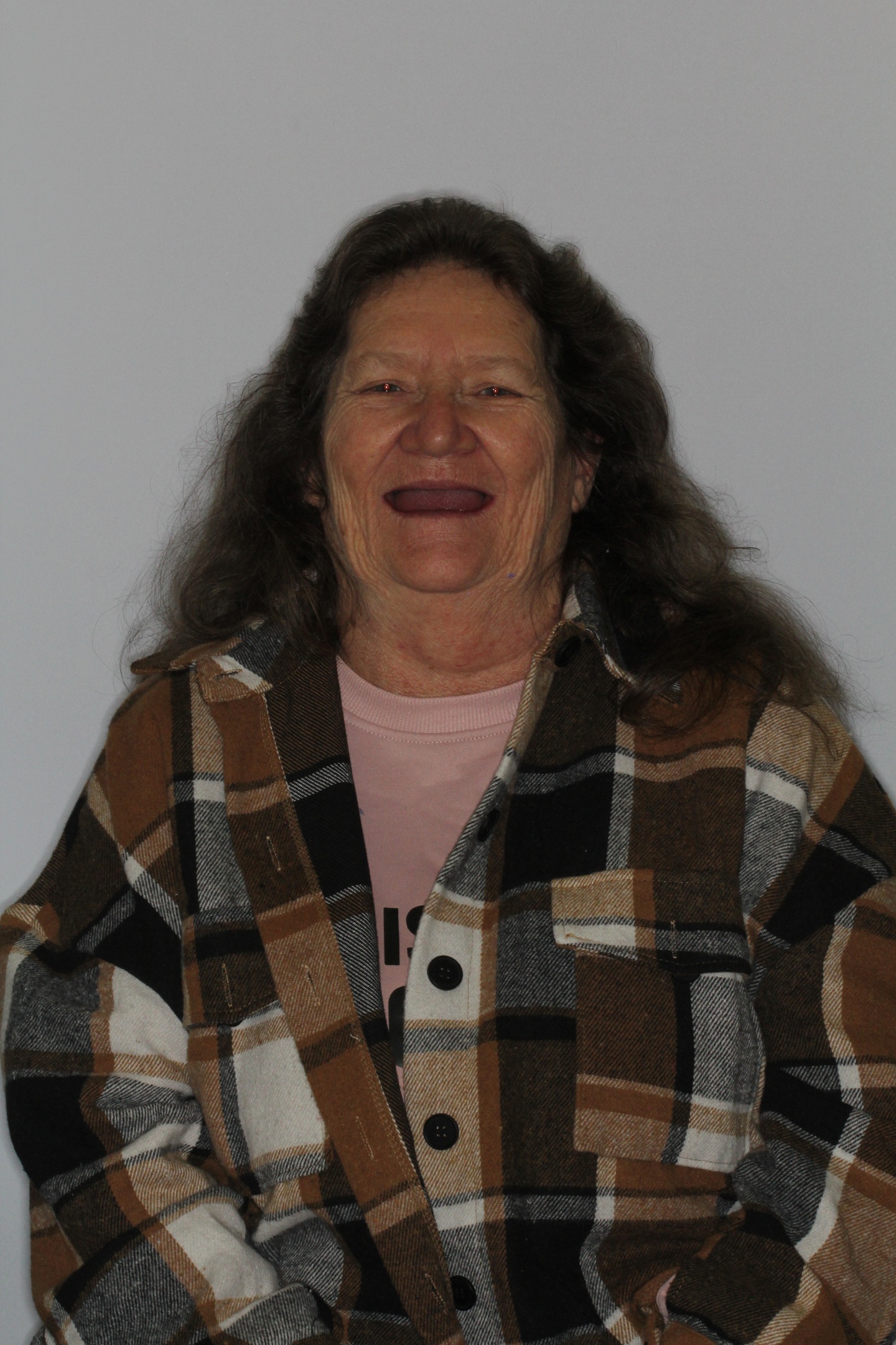 Sherry All on x before at Aer Dental Studio Candler, NC