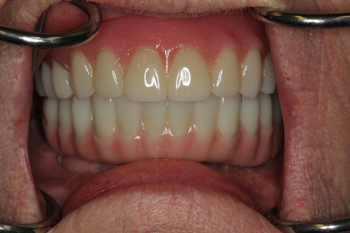 Sherry after All on x at Aer Dental Studio Candler, NC
